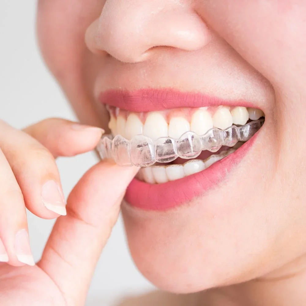 Dental Guard Night - 1-4 Adet Horlama Önleyici Bruksizm Uyku