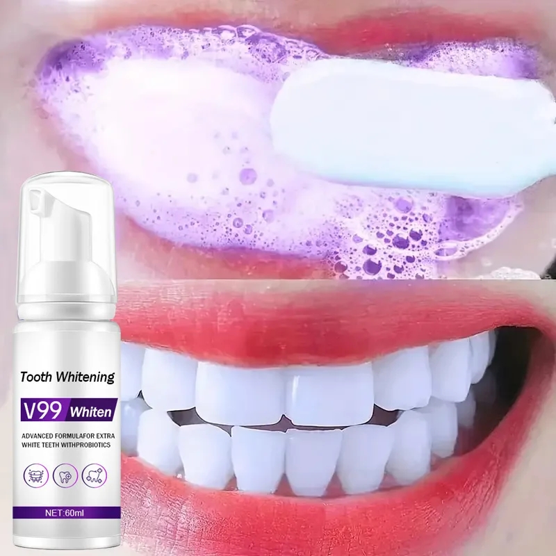 Teeth Whitening Mousse - Köpük V99 Diş Macunu Diş Temizleme