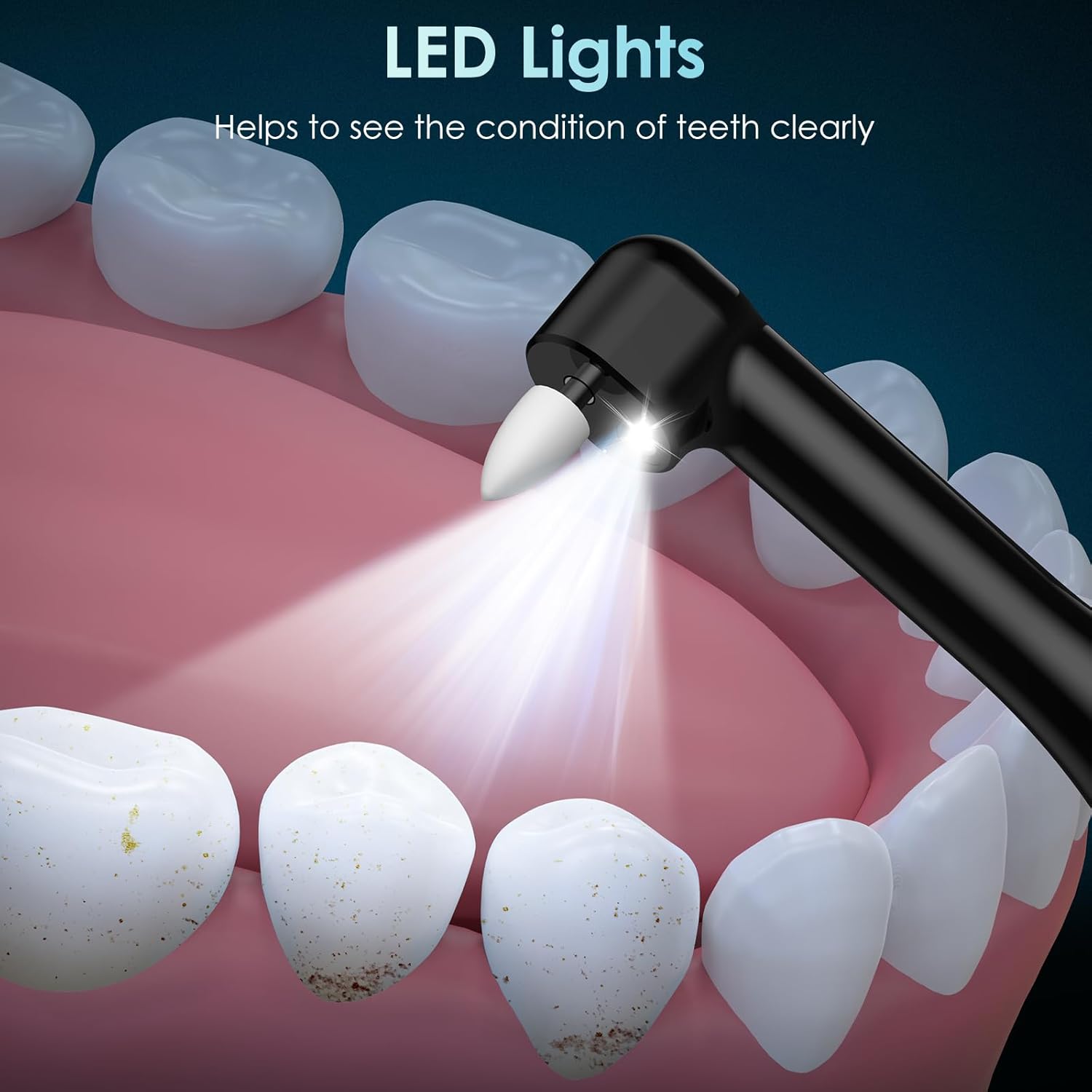 Diş Parlatıcı Şarj Edilebilir  - Teeth Whitening Or Tooth Whitening incelemesi ve fiyatı