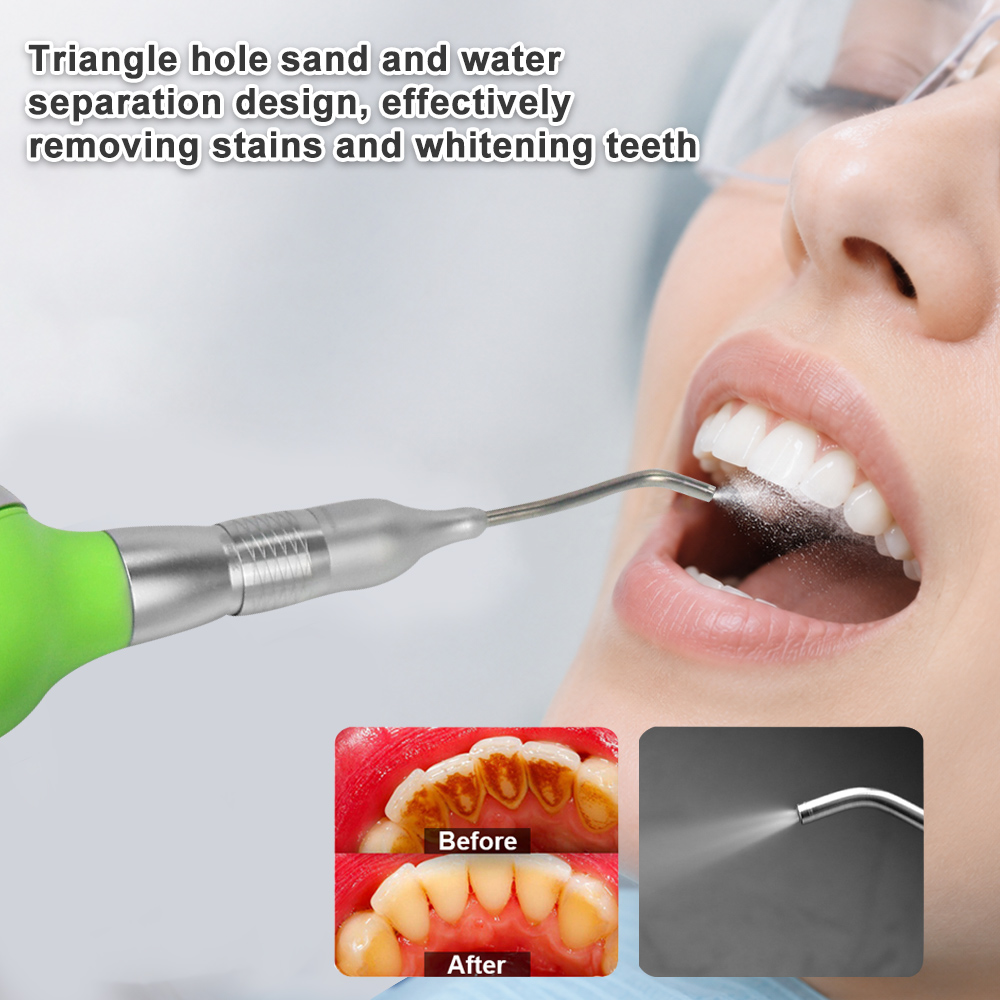 Anti-Geri Akış Cihazlı Diş Hav - Teeth Whitening Options incelemesi ve fiyatı