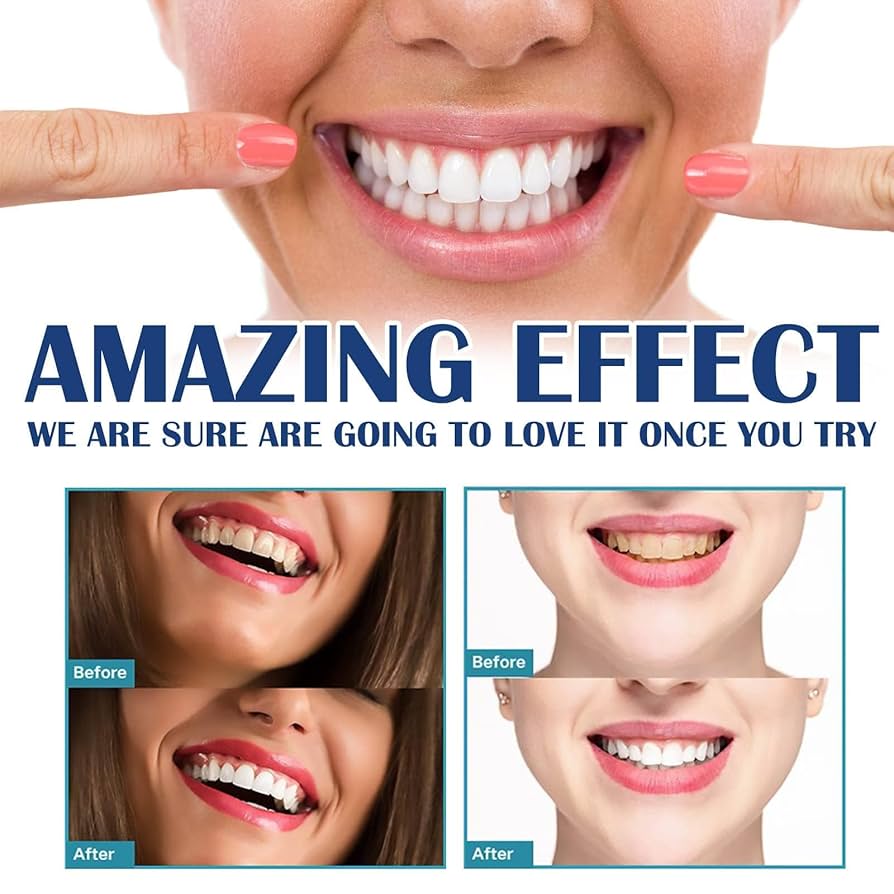 Diş Beyazlatma Çıkartmaları Na - Teeth Whitening Gel Refills incelemesi ve fiyatı
