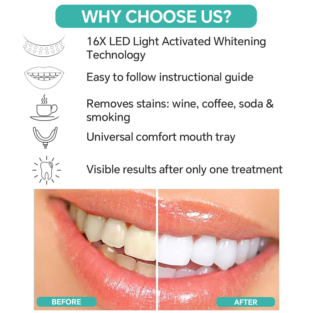 Diş Beyazlatma Güçlendirici Iş - Led Mouth Tray incelemesi ve fiyatı
