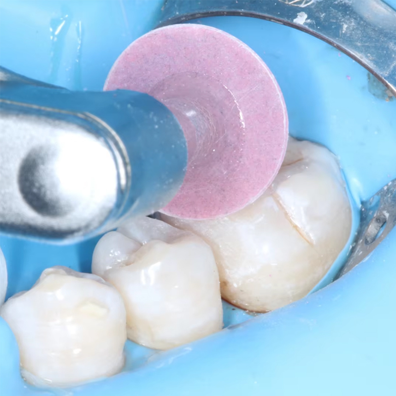 40 adet diş parlatma diski kom - Teeth Whitening Home incelemesi ve fiyatı