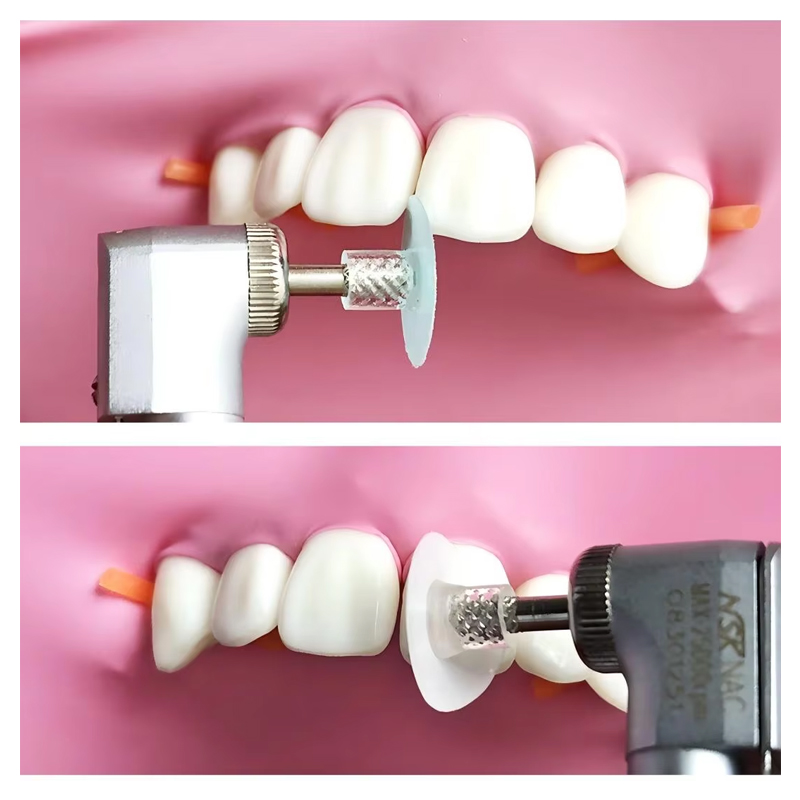40 adet diş parlatma diski kom - Teeth Whitening Home incelemesi ve fiyatı
