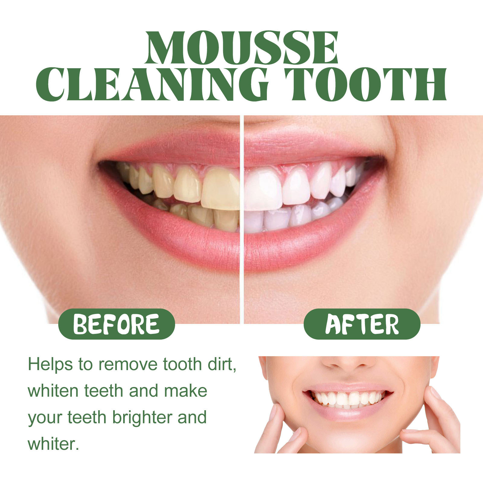 Taşınabilir Seyahat Boyu Beyaz - Teeth Whitening Mousse incelemesi ve fiyatı