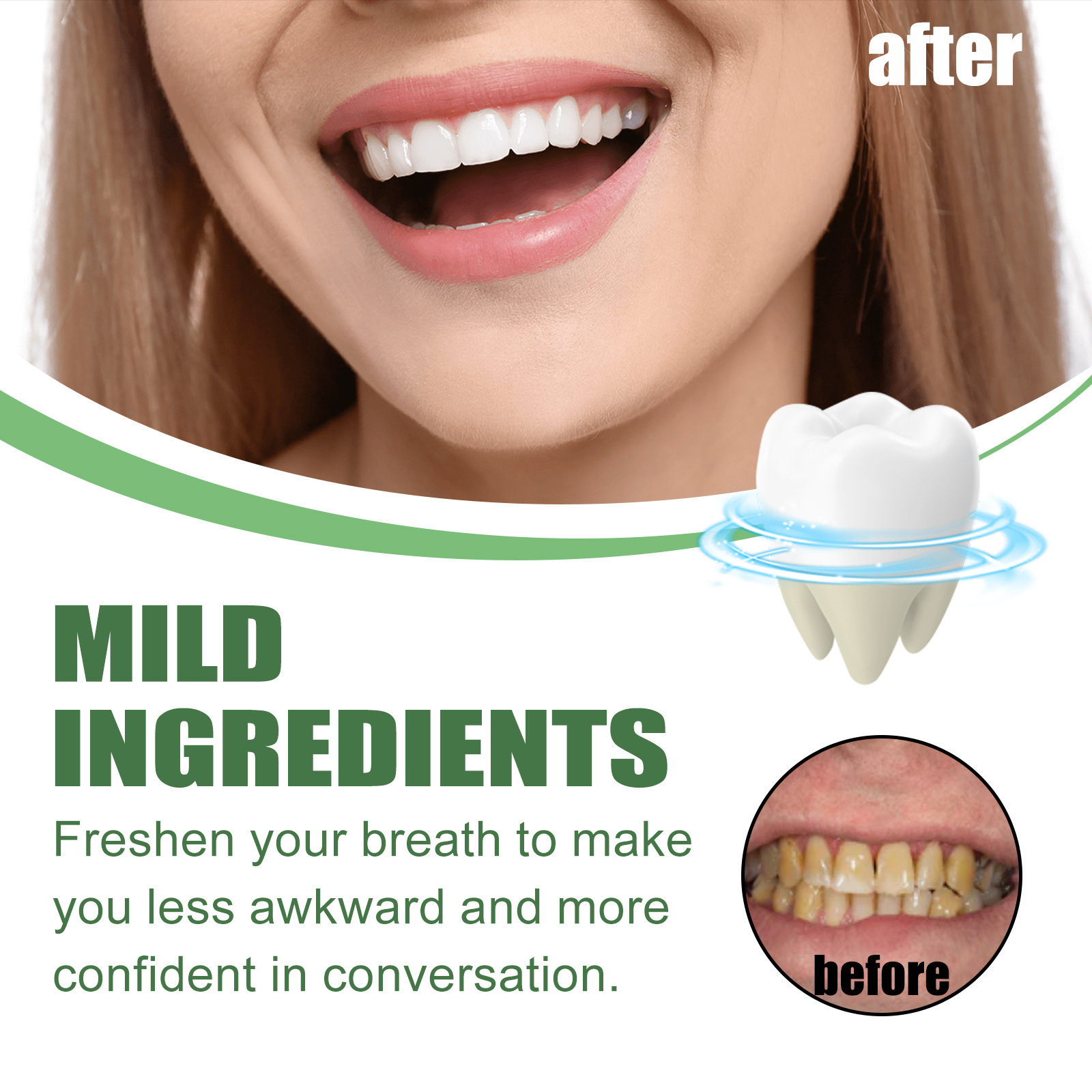 Taşınabilir Seyahat Boyu Beyaz - Teeth Whitening Mousse incelemesi ve fiyatı
