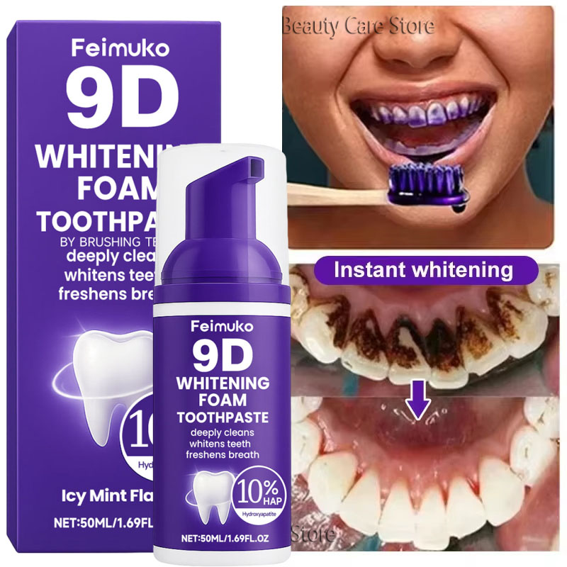 9D Mor Diş Beyazlatıcı Diş Mac - Teeth Whitening Mousse incelemesi ve fiyatı