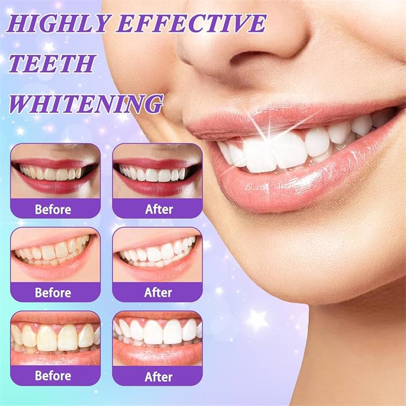 9D Mor Diş Beyazlatıcı Diş Mac - Teeth Whitening Mousse incelemesi ve fiyatı