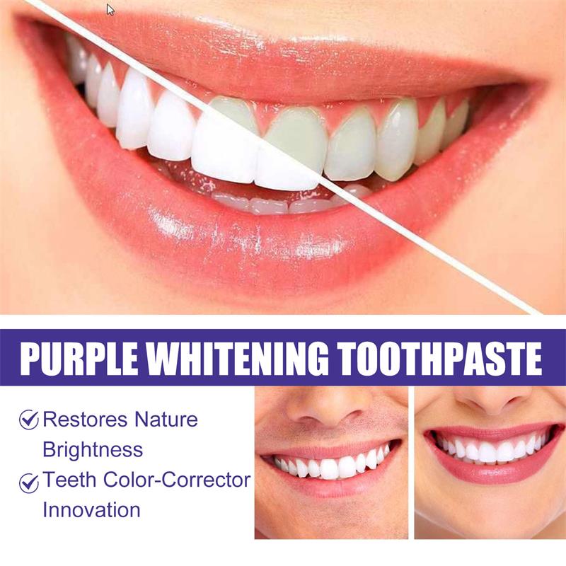 9D Mor Diş Beyazlatıcı Diş Mac - Teeth Whitening Mousse incelemesi ve fiyatı