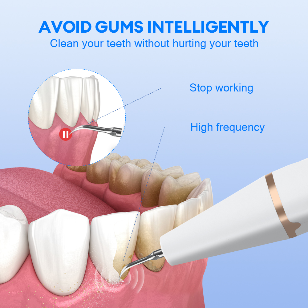 Ultrasonik Diş Tartar Temizley - Teeth Whitening And Stain Removal incelemesi ve fiyatı
