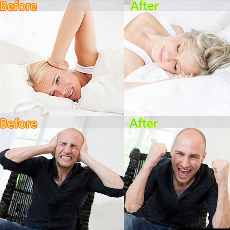 1/2/5 adet bruxizm ağız koruyu - Dental Guard Night incelemesi ve fiyatı