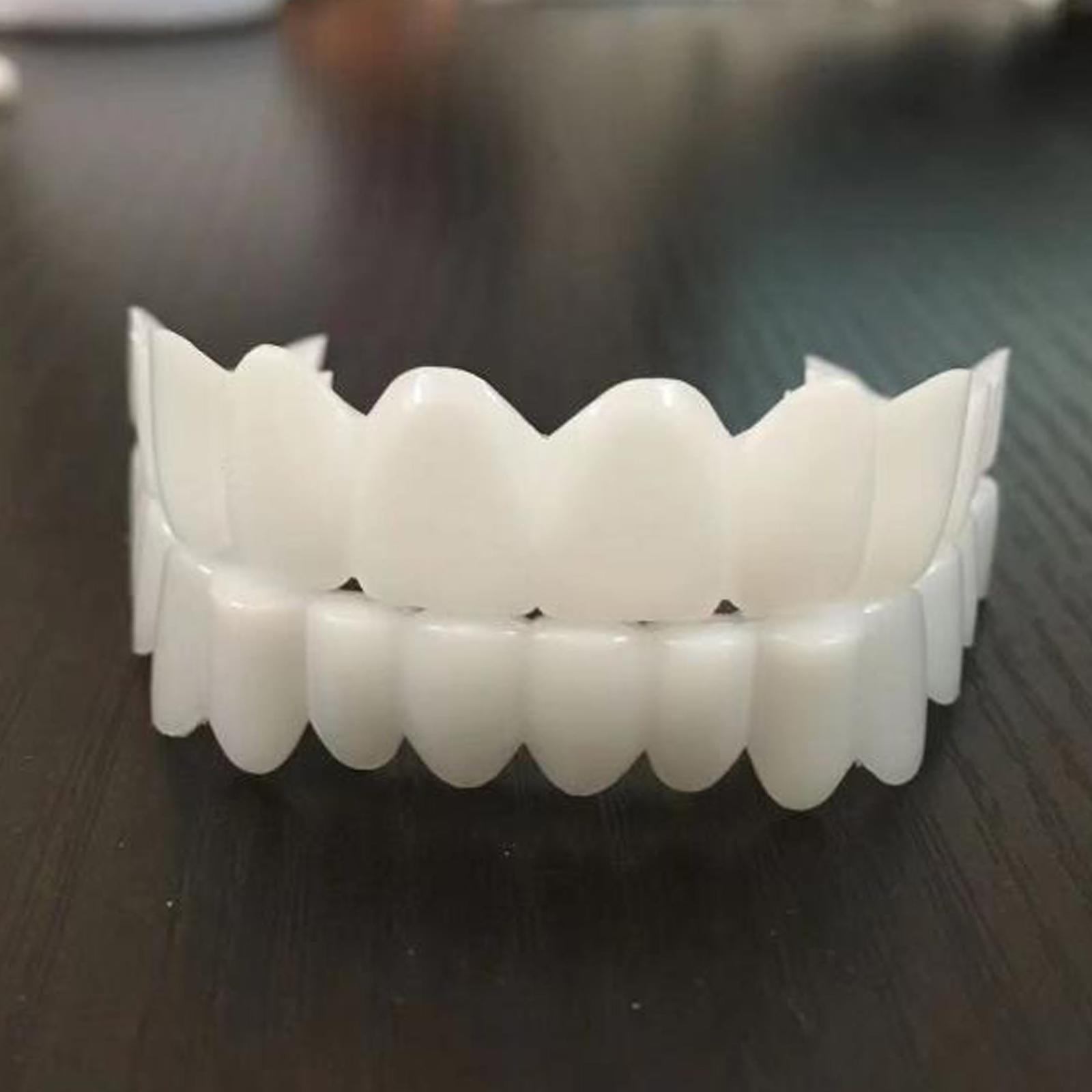Yeni Video Çekimi Özel Diş Kap - Teeth Whitening Video incelemesi ve fiyatı