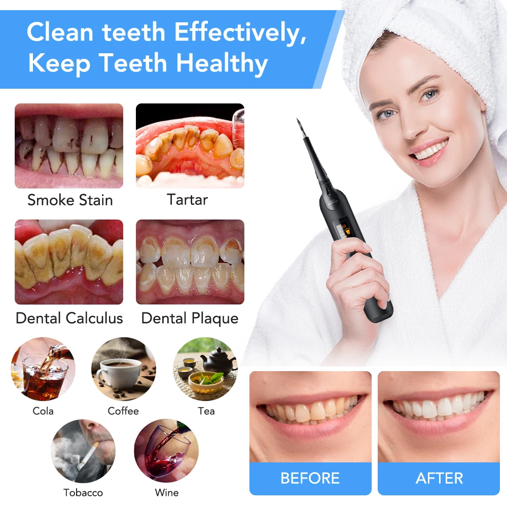Elektrikli Diş Ölçekleyici Diş - Teeth Whitening Or Tooth Whitening incelemesi ve fiyatı