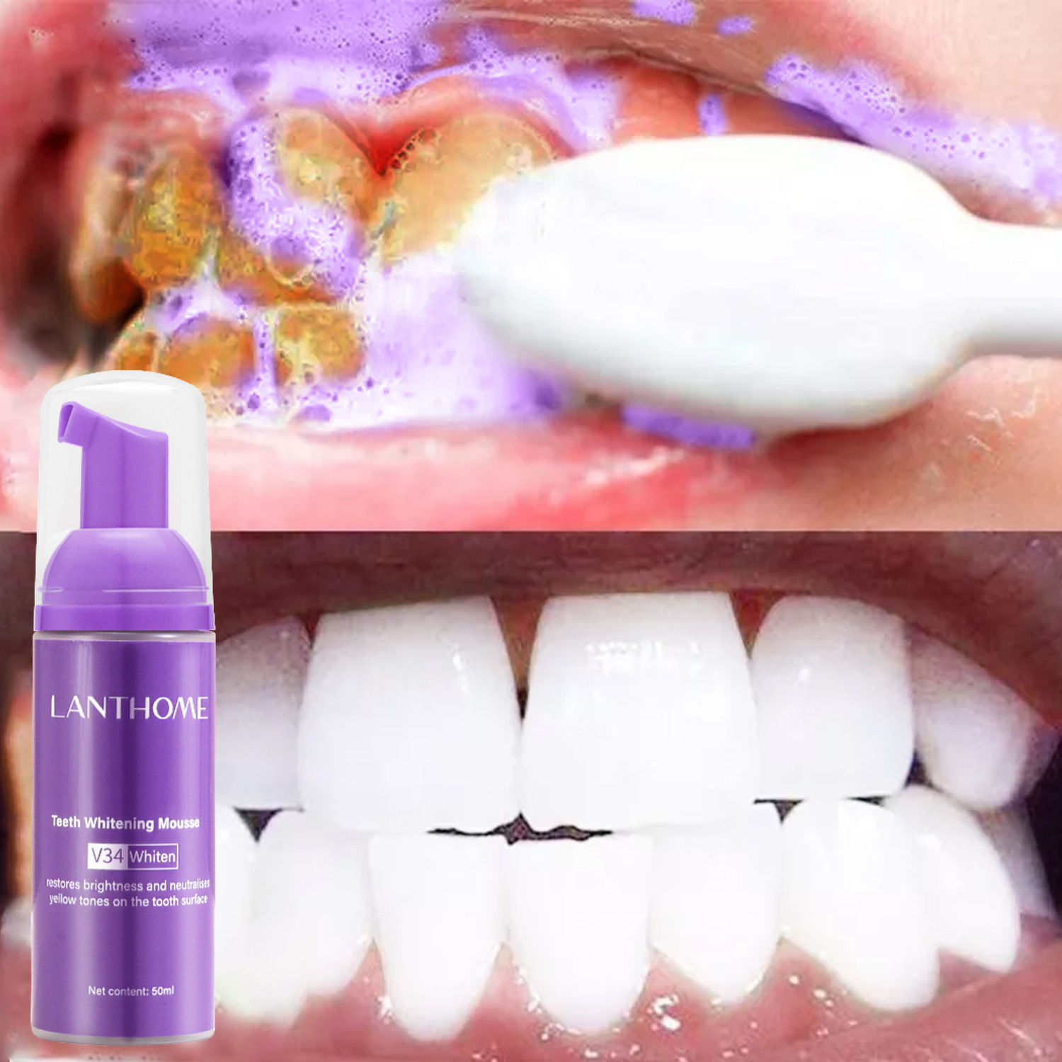 V34 Diş Beyazlatıcı Mousse Diş - Teeth Whitening Mousse incelemesi ve fiyatı