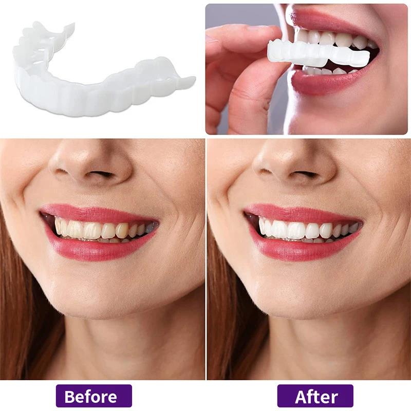 Yeni Renk Uyumlu Doğal Diş Kap - Teeth Whitening Options incelemesi ve fiyatı