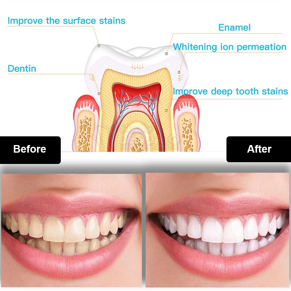 Diş Diş Beyazlatma Kiti Mini 1 - Teeth Whitening Clinic incelemesi ve fiyatı