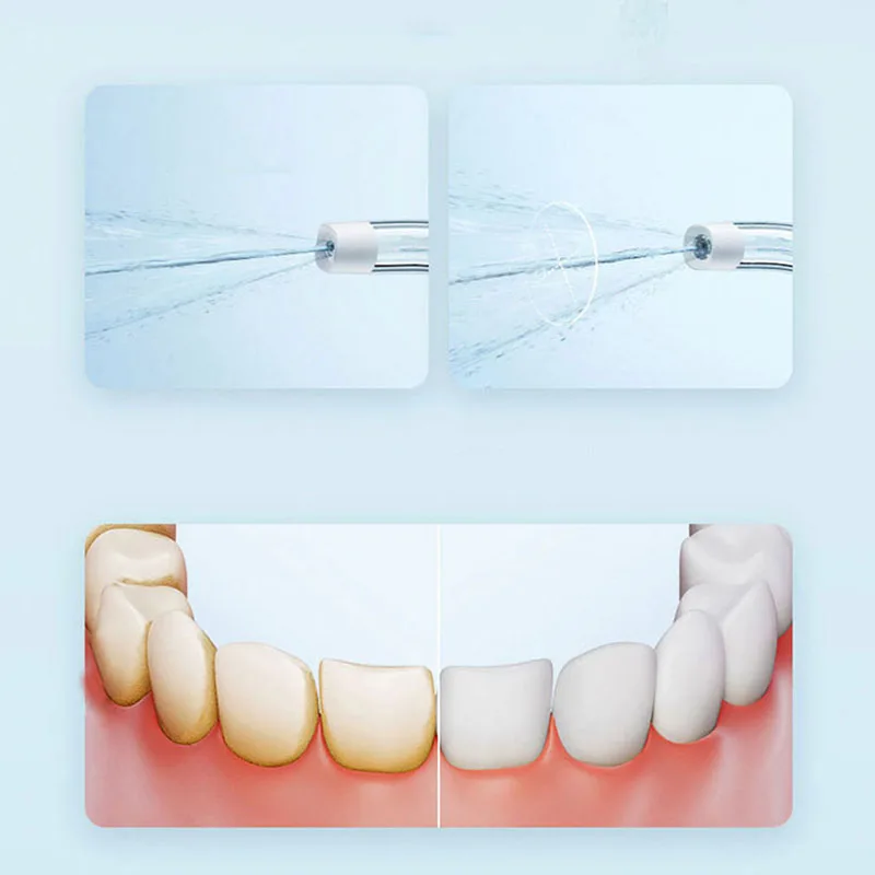 Xiaomi Taşınabilir Oral Irriga - Teeth Whitening Or Tooth Whitening incelemesi ve fiyatı