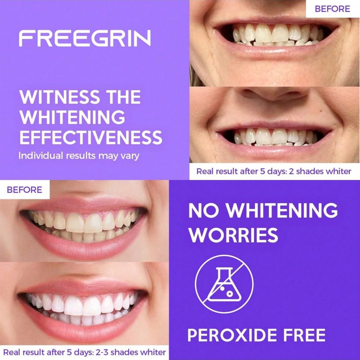 Deluxe Beyazlatma Diş Çıkartma - Teeth Whitening Gel Refills incelemesi ve fiyatı