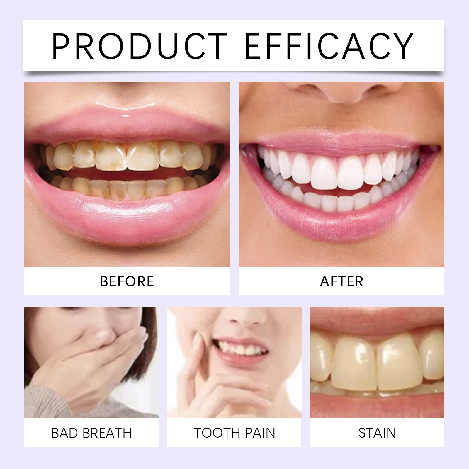 7 adet beyazlatma temizleme di - Teeth Whitening Gel Refills incelemesi ve fiyatı