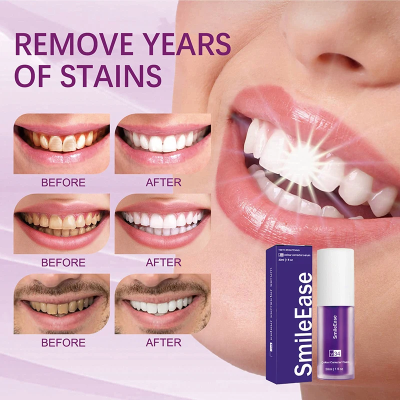 45ml Smilekit Mor Diş Köpüğü T - Teeth Whitening Mousse incelemesi ve fiyatı