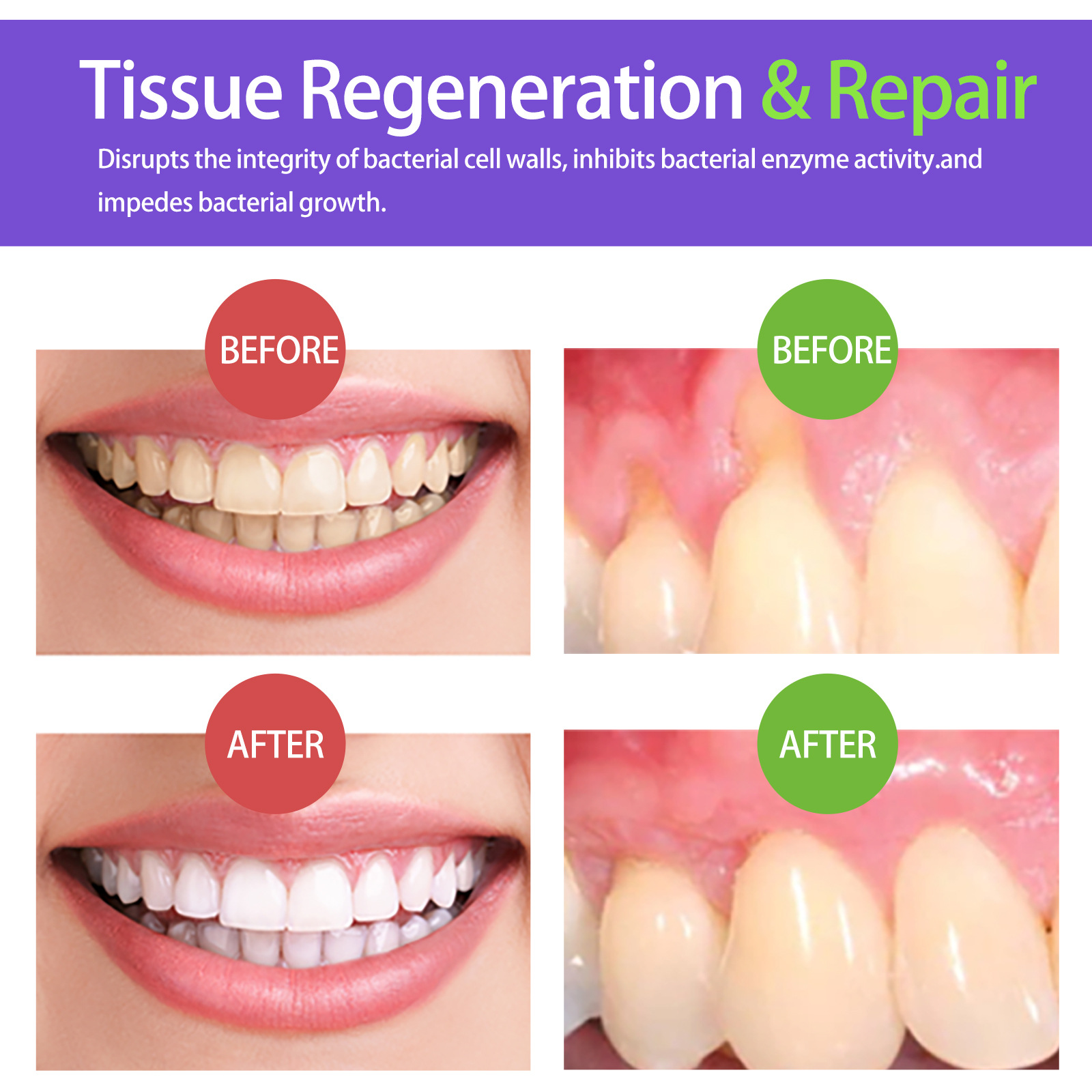 60 ml Diş Beyazlatma Köpüğü V3 - Teeth Whitening Mousse incelemesi ve fiyatı