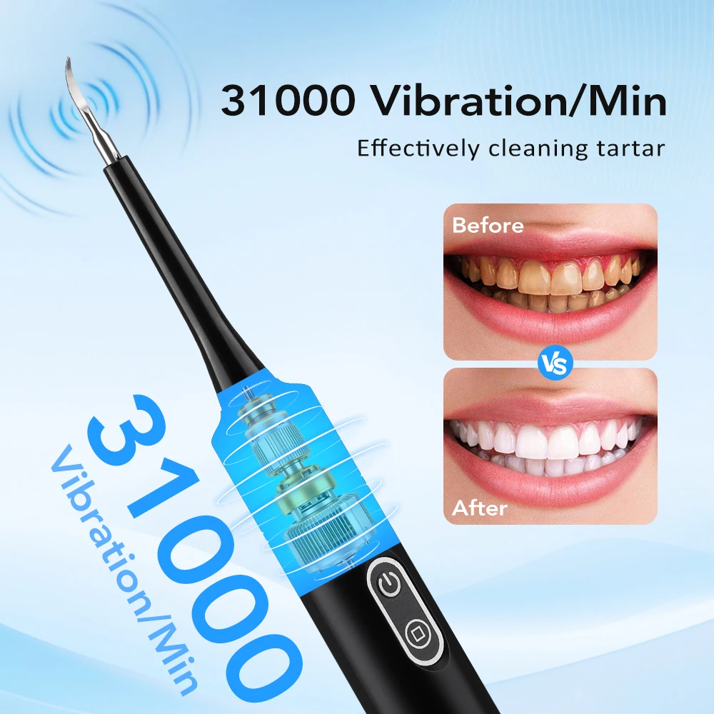 Elektrikli Sonik Titreşimli Di - Teeth Whitening And Stain Removal incelemesi ve fiyatı